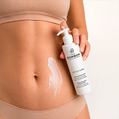 STRETCH MARKS