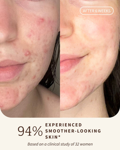 3% Bakuchiol BRIGHTENING SERUM (Travel)