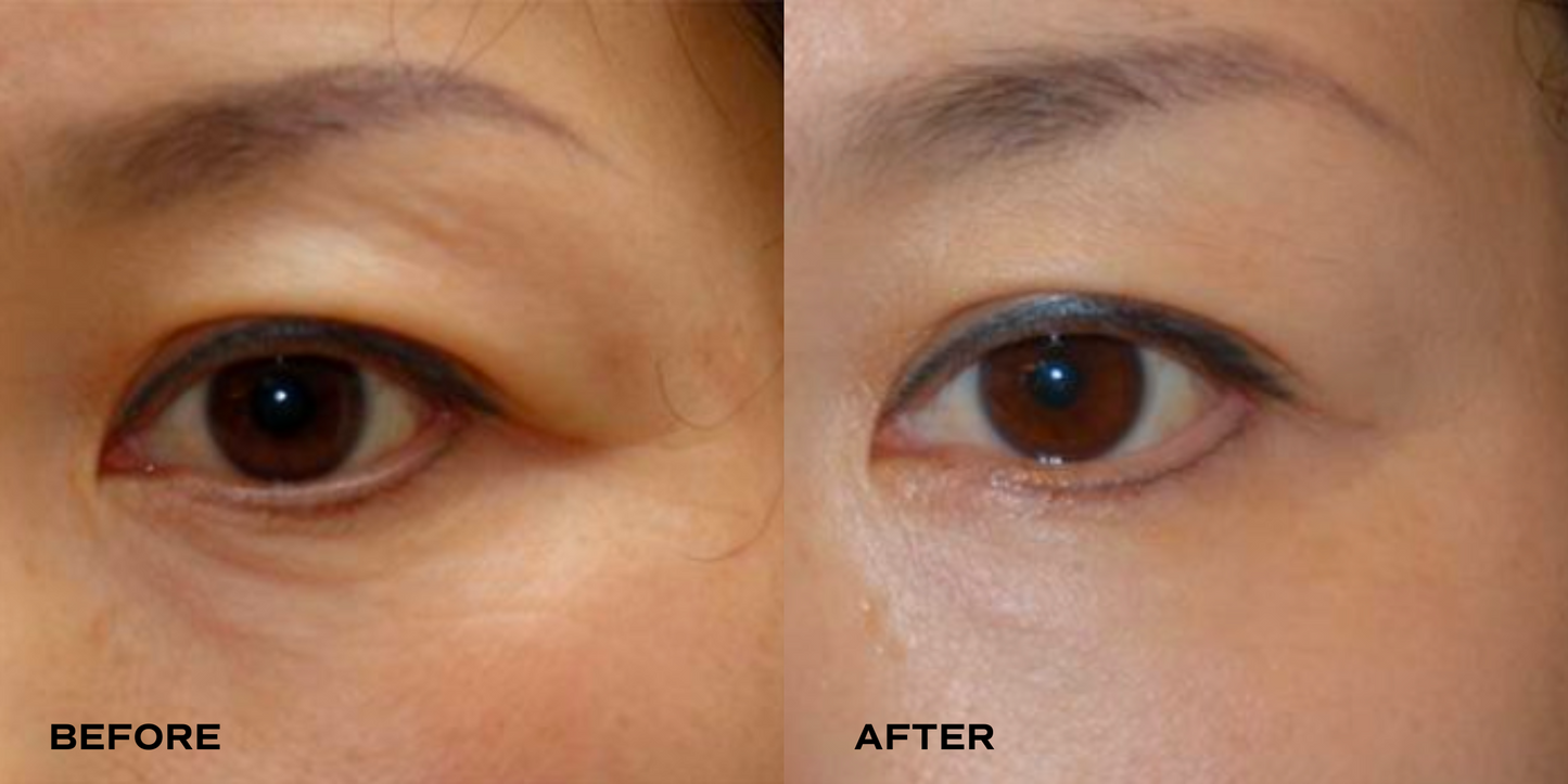 [PEPTIDE FIRMING] Revitalizing All-in-One Eye Cream