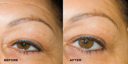 [PEPTIDE FIRMING] Revitalizing All-in-One Eye Cream