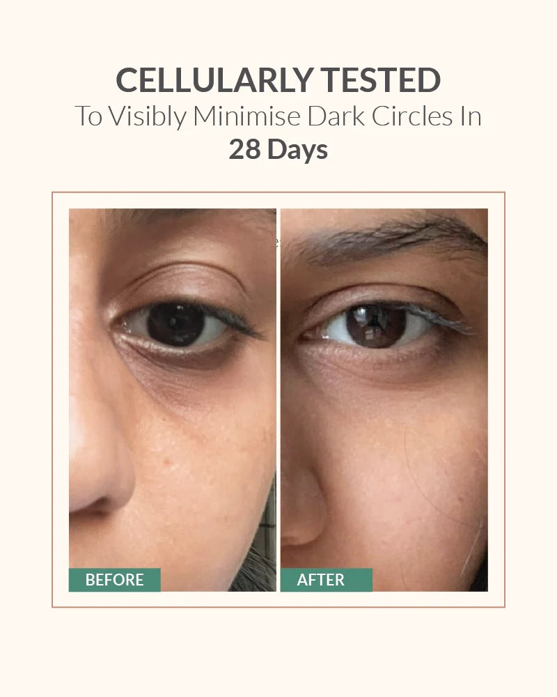 Under Eye Serum