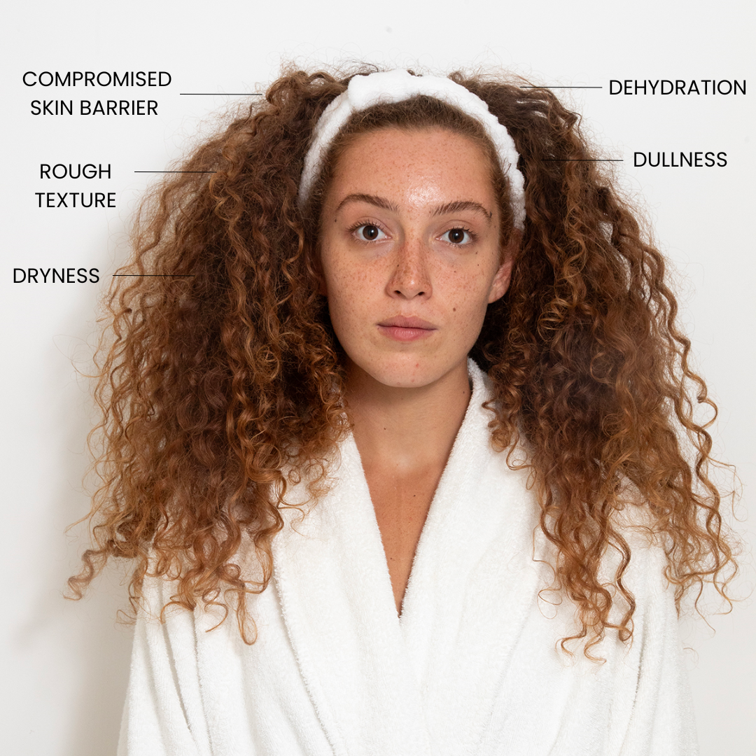 ADVANCED HYDRATING MOISTURIZER