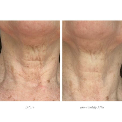 Age-Defying Body Treatment