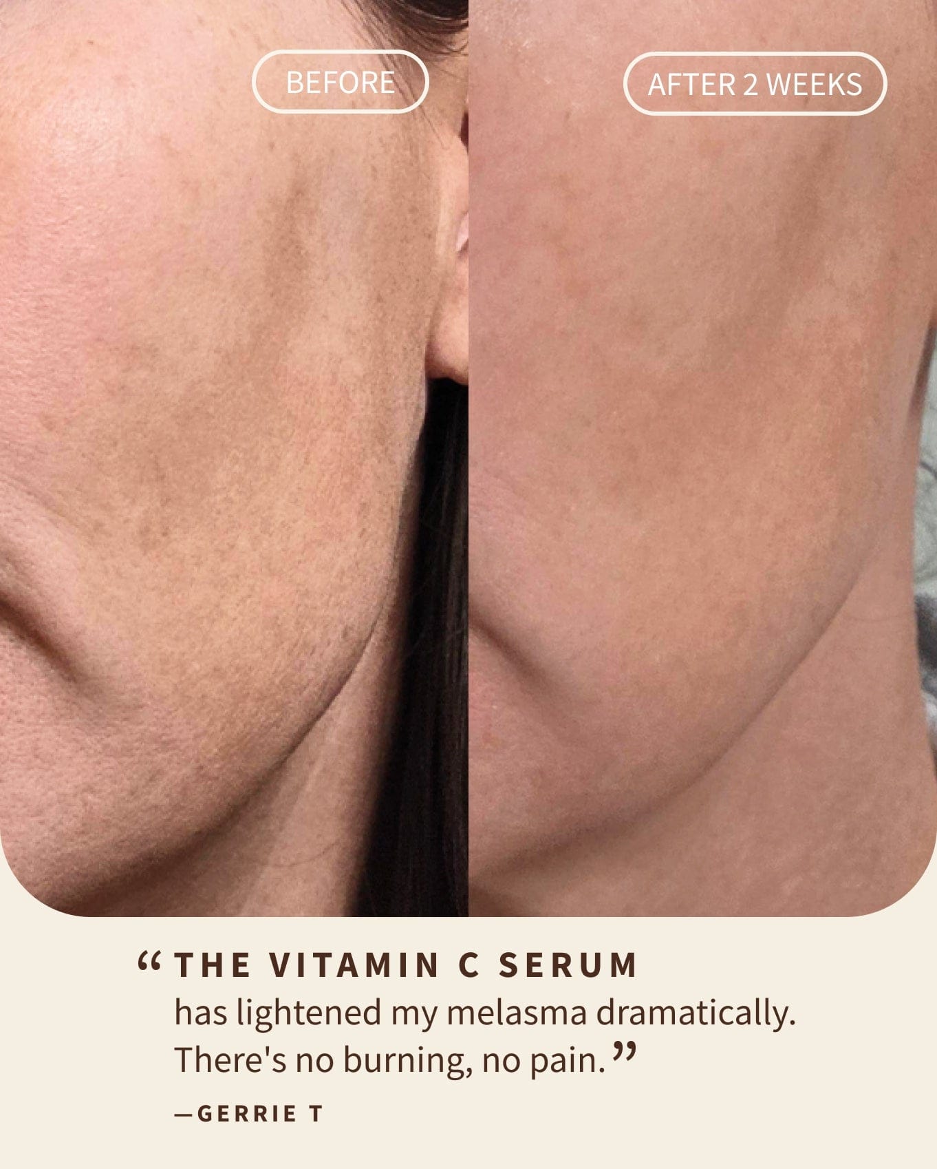 Gentle Vitamin C Glow Serum (Travel)