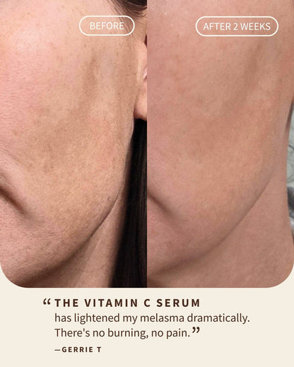 Gentle Vitamin C Glow Serum (Travel)
