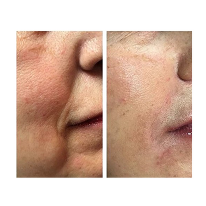 PEPTIDE COMPLEX BOOSTER