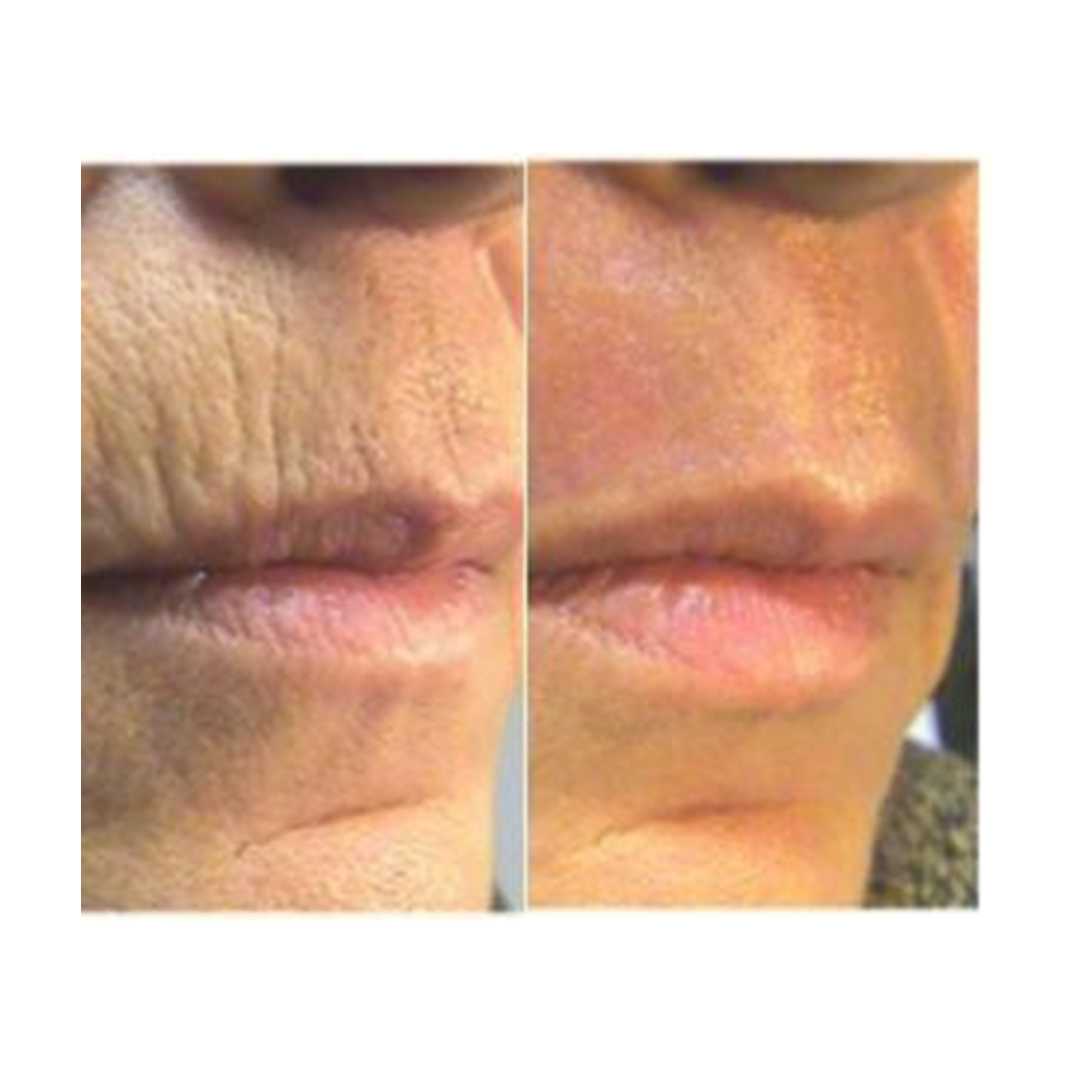 RETINOL BOOSTER