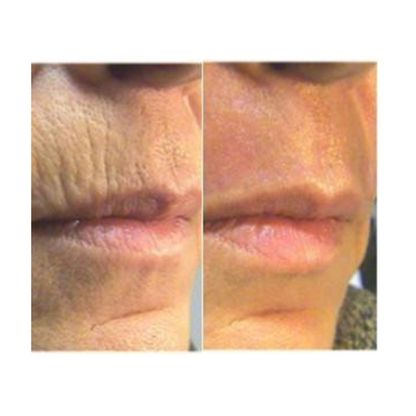 RETINOL BOOSTER