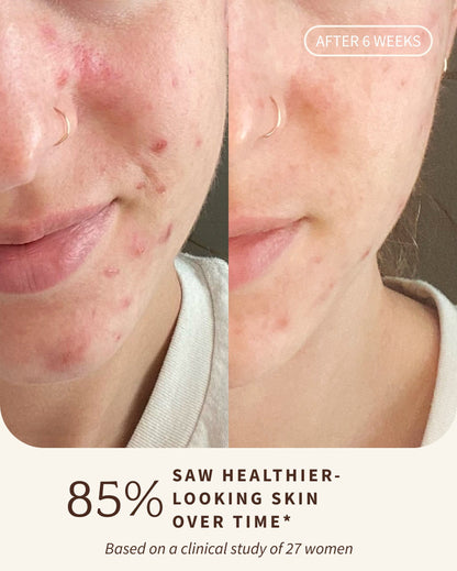 Rosewater CLEANSER (Travel)