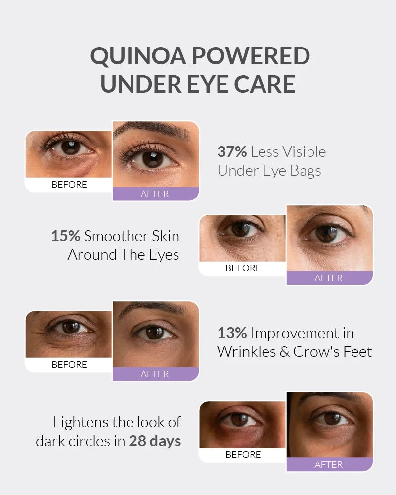 Under Eye Gel