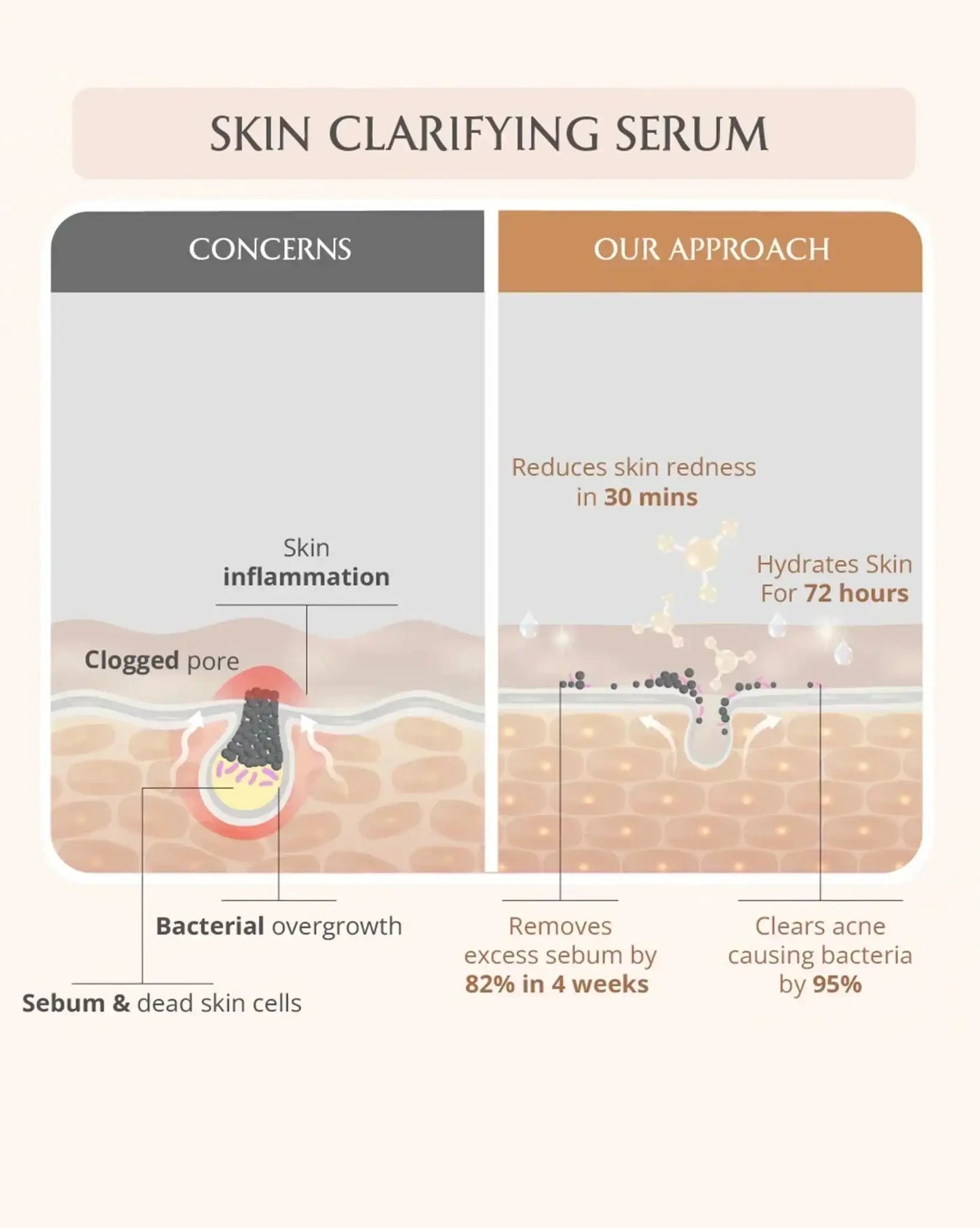 Acne Care Ritual