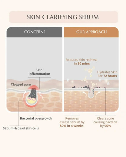 Acne Care Ritual
