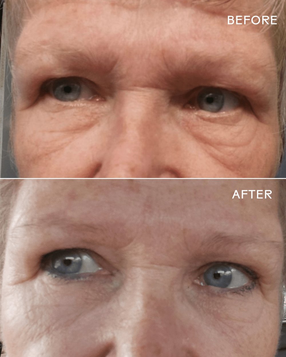EyeHero ® Bio-Retinol Smoothing Eye Cream