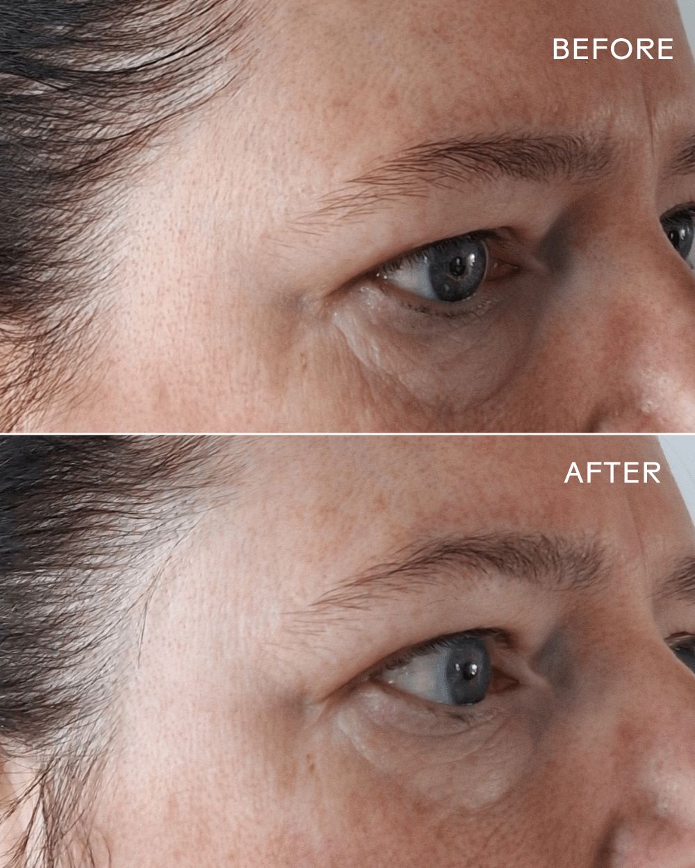 EyeHero ® Bio-Retinol Smoothing Eye Cream