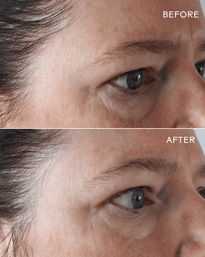 EyeHero ® Bio-Retinol Smoothing Eye Cream
