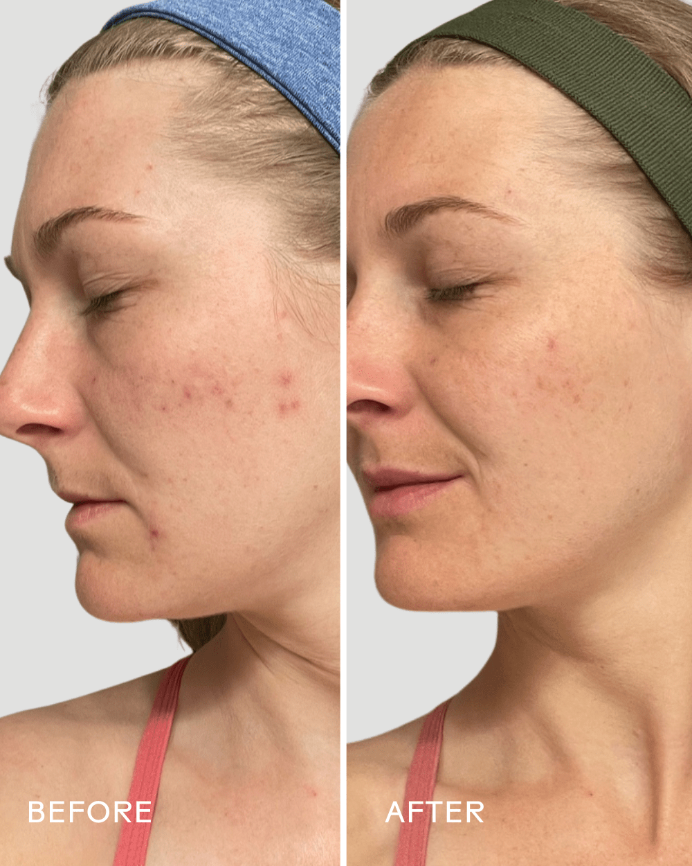 Refresh Papaya + Salicylic Acid Cleanser