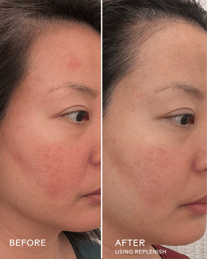 Skin Barrier Reset Routine