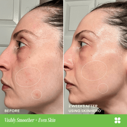 SkinHero™ Calendula + 2% Bakuchiol Bio-Retinol Serum