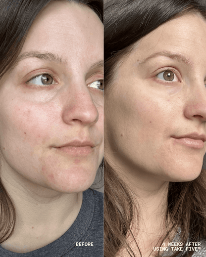 Take Five™ Hypochlorous Acid Balancing Body + Face Spray