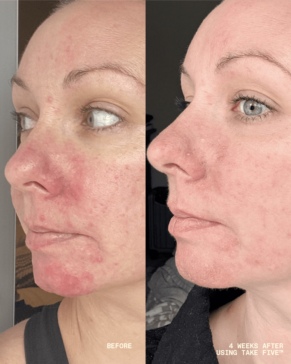 Take Five™ Hypochlorous Acid Balancing Body + Face Spray