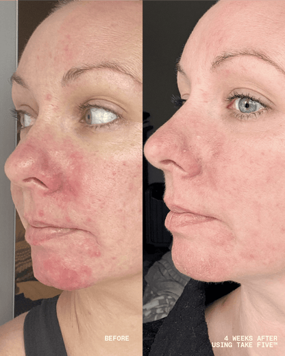 Take Five™ Hypochlorous Acid Balancing Body + Face Spray