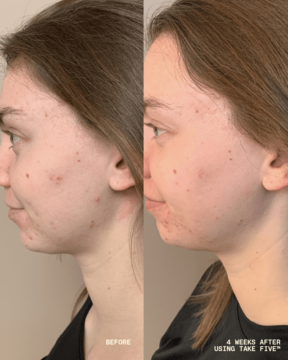 Take Five™ Hypochlorous Acid Balancing Body + Face Spray