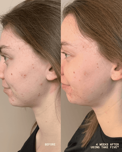 Take Five™ Hypochlorous Acid Balancing Body + Face Spray